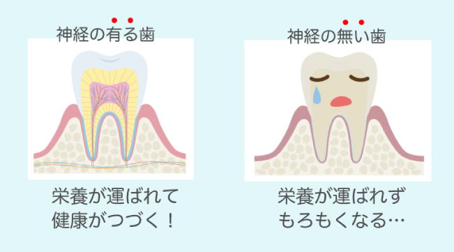 歯の神経を抜いても大丈夫?